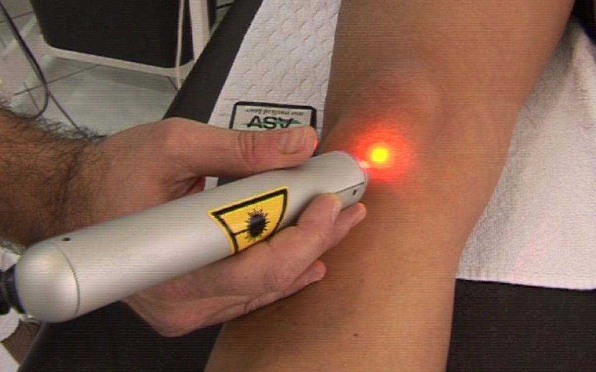 LASER ΣΗΜΕΙΑΚΟ