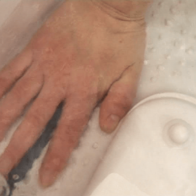 ΥΔΡΟΘΕΡΑΠΕΙΑ