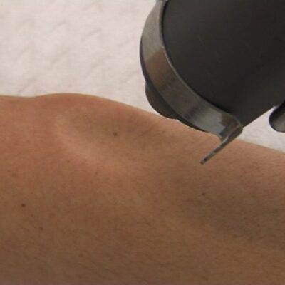 Εξαγωγή ψυχρού αέρου (έως -32 βαθμούς Κελσίου) από σημειακή κεφαλή για εφαρμογές σε μικρές επιφάνειες